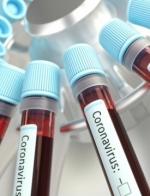 Коронавірус: у світі знову фіксують рекорд добової захворюваності