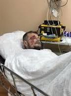 Стан здоров'я Мосійчука важкий, він у реанімації