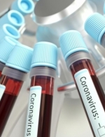 В Україні зареєстрували 549 хворих на COVID-19