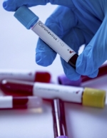 У США починають тестувати вакцину від коронавірусу