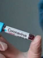 МОЗ закупило тести на коронавірус для понад 90 тисяч осіб