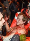 За попередніми даними, сьогодні в Києві було вбито більше 60 протестувальників