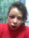 У Пшонки заявляють, що на Чорновол напали з хуліганських мотивів