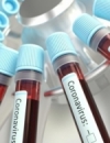 в Україні виявили менше 10 тисяч нових випадків коронавірусу