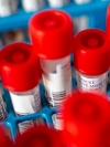 В Україні підтвердили 29 випадків коронавірусу