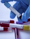 Тести підтвердили загибель третьої українки від коронавірусу в Італії