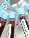 В Україні зареєстрували 549 хворих на COVID-19