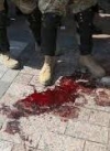 21 військовослужбовець з тих, хто постраждав біля Верховної Ради 31 серпня, досі на амбулаторному лікуванні